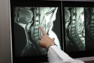 Röntgen des Halses