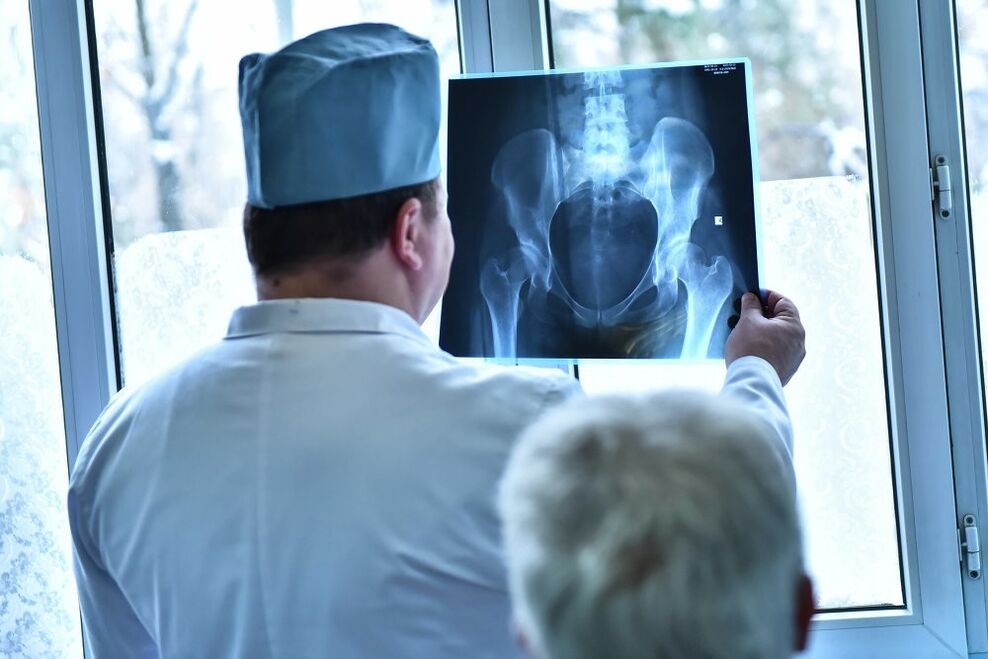 Der Arzt untersucht das Bild eines Hüftgelenks mit Arthrose