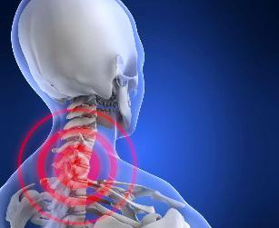 Der Ort der Lokalisierung von Schmerzen in der Halswirbelsäule Osteochondrose